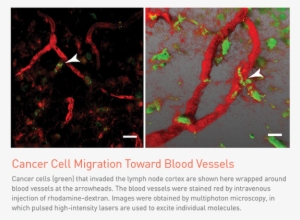 They Discovered This By Using Image Analysis, Which - Massachusetts #4081028