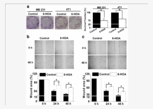 Hoa Inhibits Breast Cancer Cell Growth And Migration - Fig.1 #4081724