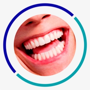 Oral Rehabilitation - White Teeth Smile With Dental Mirror #4092166