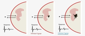 Llustration Of Three Breasts At Different Stages Which - Circle #4096629