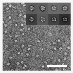 Bild - Aaa Atpases Negative Staining #4107303