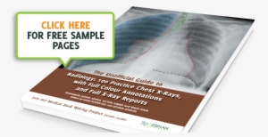 Unofficial Guide To Radiology - Radiology #4108409