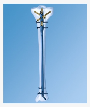 Titanium Cannulated Tibial Nail Ex - Synthes Tibial Nail #4127787