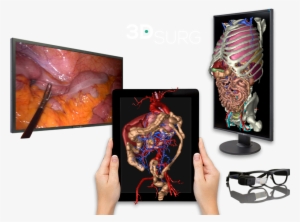 3d Technology Applied To Surgery - Surgery #4157878