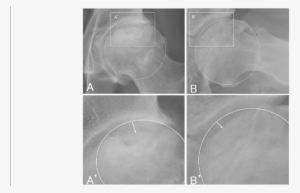 Collapse Extent Is Defined As The Distance Between - Circle #4172264