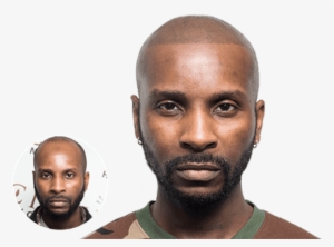 When I Looked In The Mirror After My Msp I Was So Amazed - Vinci Hair Clinic #4263675