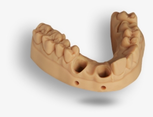 3d Printing Is The Catalyst For Digital Dentistry - Dental Models 3d Printed #4275886