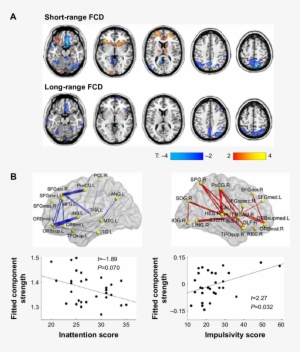 Disturbed Connectivity In Adhd - Notes Disturbed #4289520