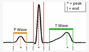 Delineated Normal Heartbeat [25] - Methadone #4348161