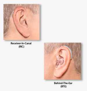 Of Hearing Loss - Diagram #4361008