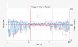 Green Light Processed With Matlab From An Oeps Signal - Diagram #4373987