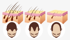 Hair-loss - Sebamed Anti Hair Loss Shampoo Review #4375181