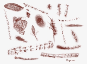 Wounds And Stitches By Raptura Stitches Png - Stitches #4375211