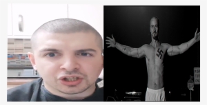 Bald Gore Omegalul - Hair Loss #4393110