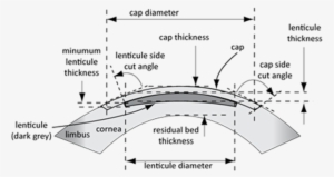 At Present This Requires A Curved Suction Cup Placed - Diagram #4394601
