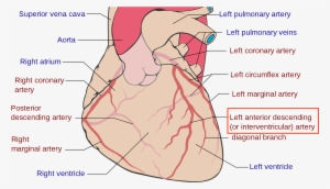 What Is A Widow-maker Kevin Smith's Scary Symptoms - Coronary Arteries #4398200