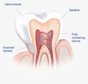 What Causes Sensitive Teeth - 牙 本质 #4413980 What Causes Sensitive Teeth - 牙 本质 #4413980