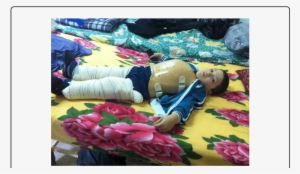 Equipment-two Plaster Splint And A Garchoix Corset - Orthopedic Cast #458595