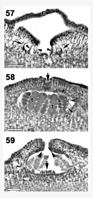 Section Through A Young Tetrasporangial Conceptacle - Cartelas De Bingo Para Imprimir #4503869