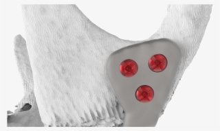 3angle Plate Transparent - Poppy #4525839