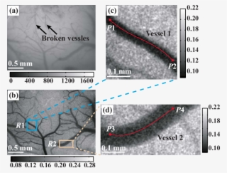 A White Light Image Of The Rat's Left Parietal Lobe - Rat Laser Speckle Contrast Imaging #4536779