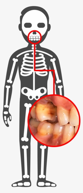 Pancreas - Human Body Illustration Png #4546335
