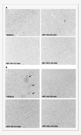 Abt 100 Affects Tumor Cell Proliferation And Apoptosis - Monochrome #4556689