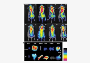 In Vivo Fluorescence Imaging Of Intracranial U87 Mg - U87 #474548