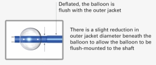 Features And Benefits - Balloon Guide Catheter #4715180