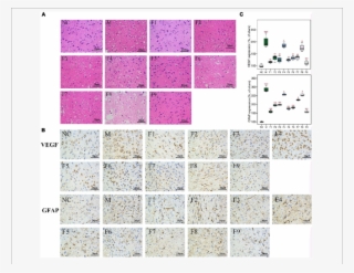 Histopathological Examination Of Brain Tissues By H&e - Art #4740045