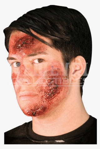 Burn Scar Png Graphic Freeuse Stock - Rotting Rash Latex Prosthesis #4745902