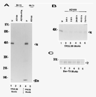 Expression Of Mhc Class I Heavy Chains In Hcmv Wild - Strain #4755011