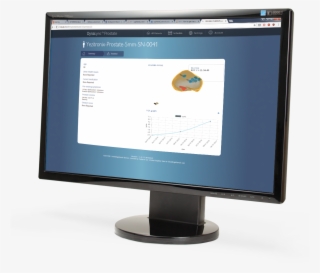 Dynalync Prostate Computer Screen - Computer Monitor #4781147