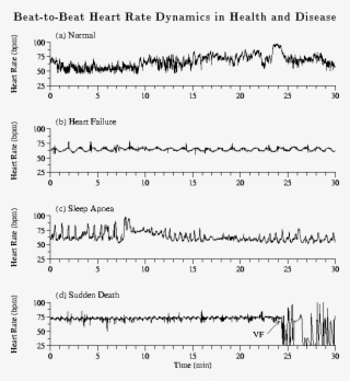 Heart Rate Time Series Of 30 Min From (a) A Healthy - Heart Failure Heart Beat #4787821