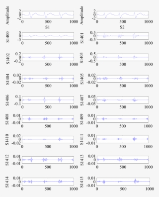 Results Of Ecg Signal Decomposition Using Wpd - Electric Blue #4788024