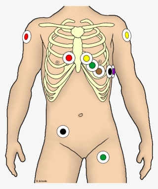 Ekg Ableitung Unter Rettungsdienst Bedingungen - 12 Kanal Ekg Kleben #4788533