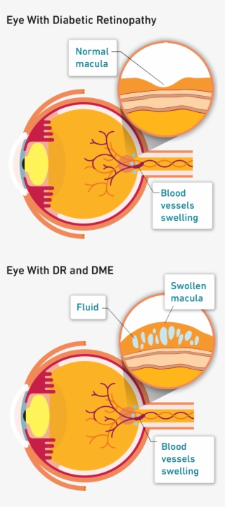 If You Have Diabetes And Are Experiencing Problems - Orange #4791836