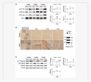 7 Month Old Pigs Were Given The Aac Or The Sham Operation, - Tau Protein #4861423