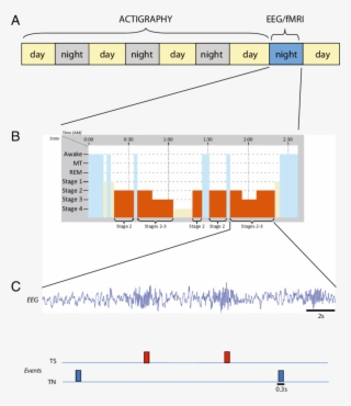 Volunteers Were Recorded With Eeg/fmri During The Experimental #4872580 Volunteers Were Recorded With Eeg/fmri During The Experimental #4872580