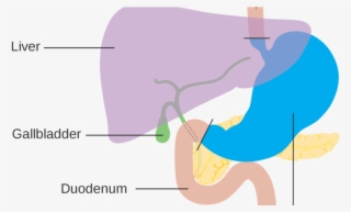 Facts About Stomach Cancer - Stomach Cancer #4911410 Facts About Stomach Cancer - Stomach Cancer #4911410