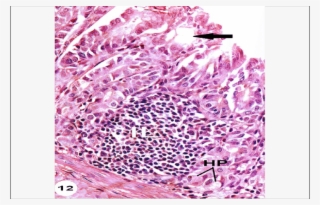 Cross Section Of Stomach Of Rat Treated With #4912876 Cross Section Of Stomach Of Rat Treated With #4912876