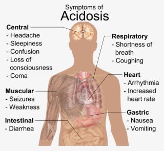 Symptoms Of Acidosis - Importance Of Ph In Daily Life #4917034