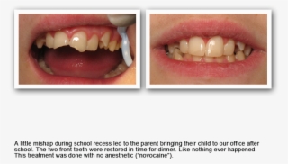 Gallery20 - Cosmetic Dentistry #5013285