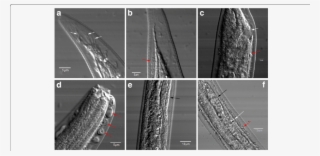 Morphological Features Of Haemonchus Contortus Larvae - Haemonchus Contortus #5023375