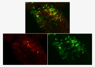 Entire Larva - - Graphic Design #5024148