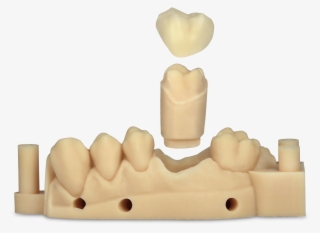 Try Watching This Video On Www - Dental Laboratory #5086368