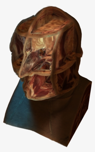 Cross-section Of A Human Head - Human Head #5112487