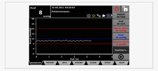 Liquoguard Monitor Demonstrating Current Cerebrospinal - Journal Of Endovascular Therapy #5117238