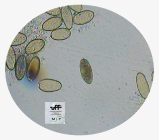 Ovo Fasciola 1 - Federal Fluminense University #5121912