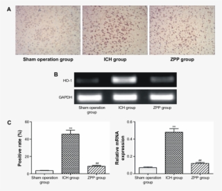 Effect Of Zpp On Brain Tissue Ho 1 Expression In Ich - Architecture #5124575